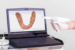 Computer screen with a scan of a mouth and a digital wand.